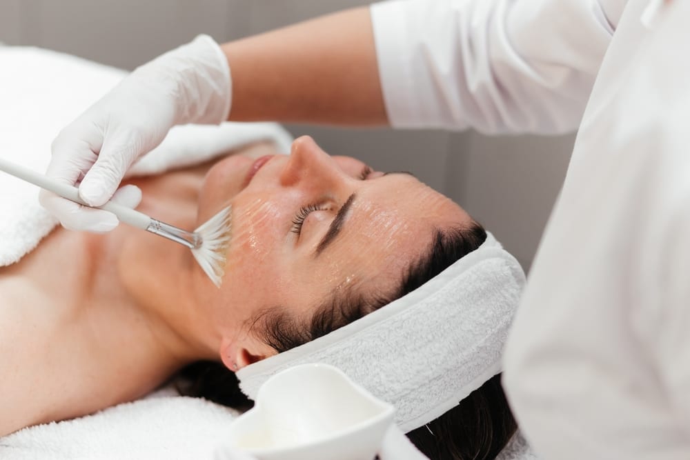 Medical-grade chemical peel treatment