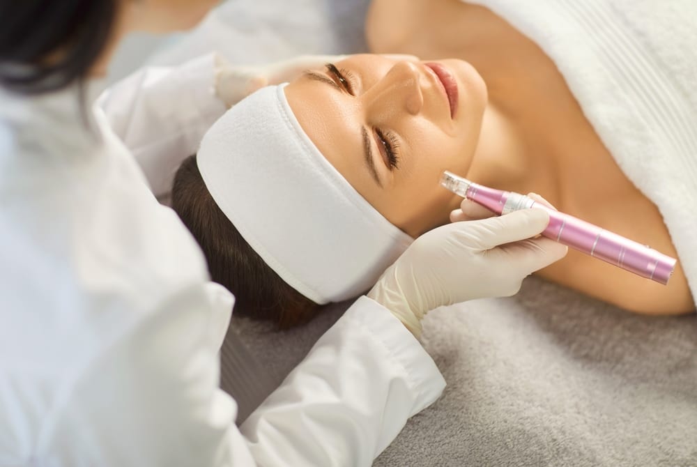 Microneedling collagen-induction treatment