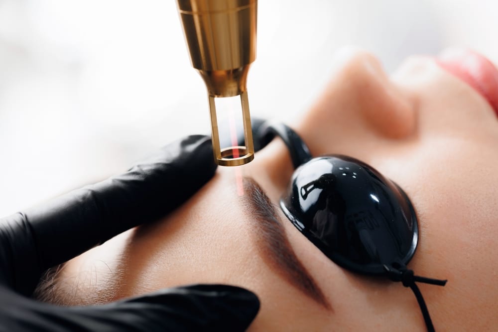 Erbium laser skin resurfacing treatment